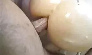 ანალური შპრიცი კრემი ...