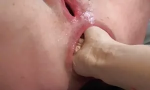 მეძავი ტრაკი მტკივნე ...